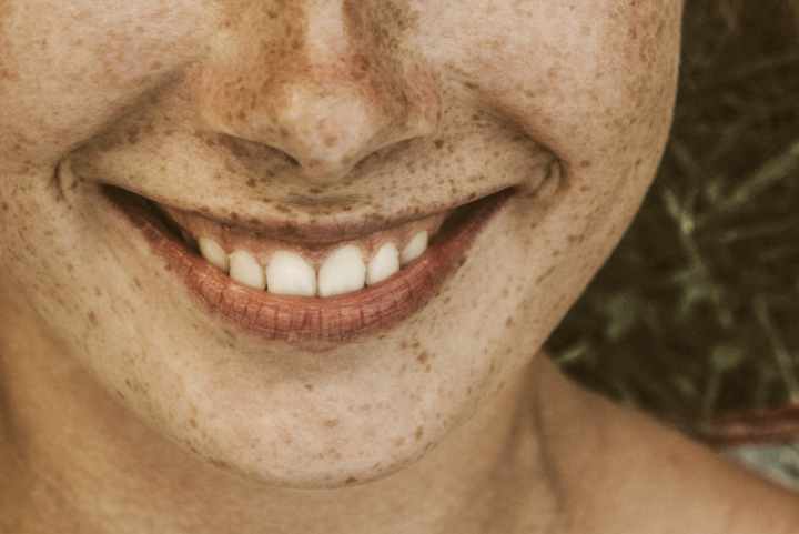 Girl smiling with pearly white teeth.
